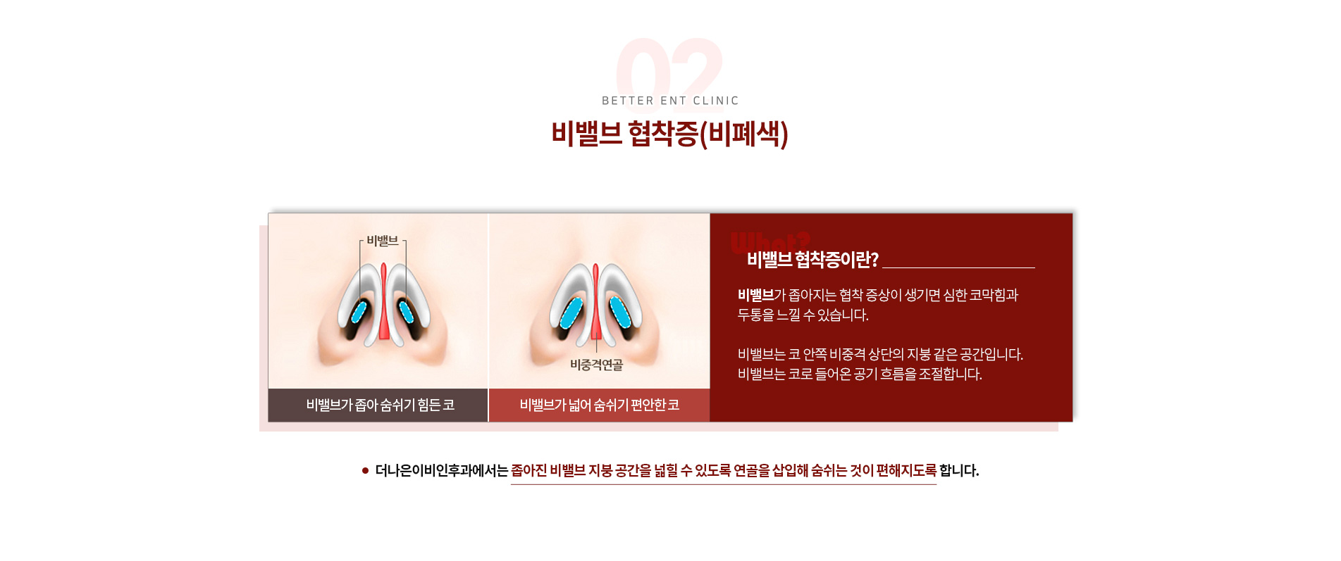 더나은 이비인후과 기능코 미용 비밸브 협착증